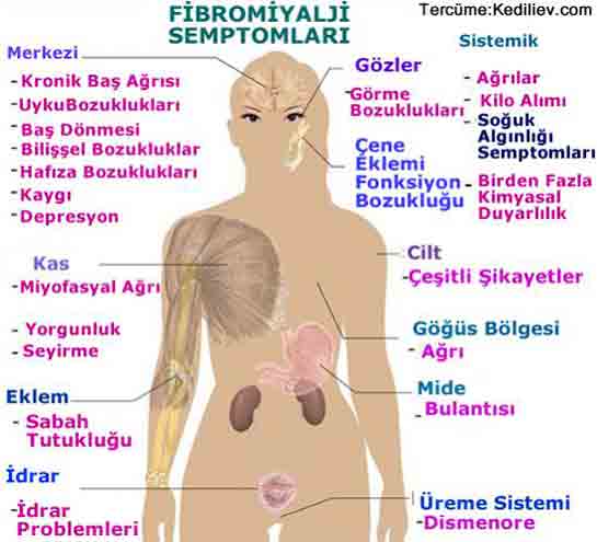 Fibromiyalji Testi