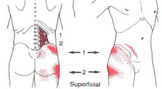 Yumuak Doku Romatizmas Fibromiyalji